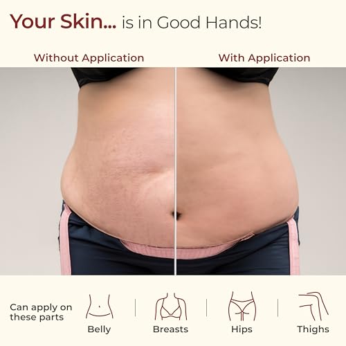 LuvLap Pregnancy Stretch Mark Oil - 80ml, Safe & Effective